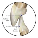 Ортодонтия Семинар